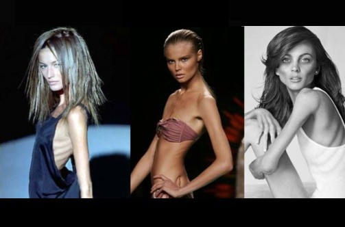 Anoressia nella moda, petizione online al Ministro Lorenzin