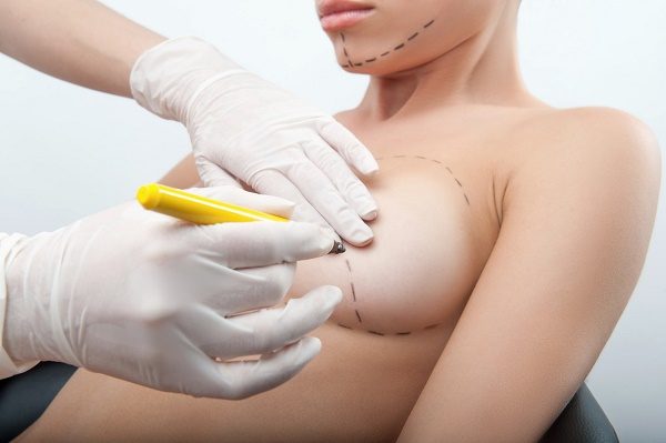 Aumento del seno, 5 cose da sapere sulla mastoplastica