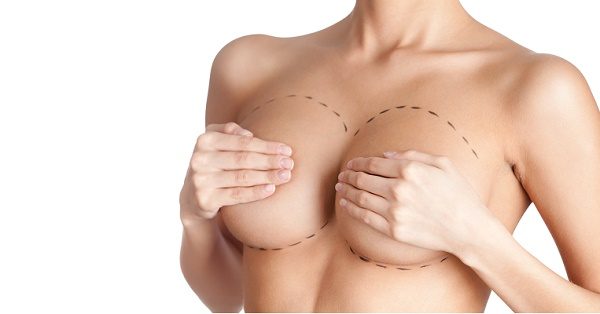 Rifarsi il seno: 7 miti da sfatare sulla mastoplastica additiva