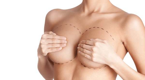 Protesi al seno quali scegliere?
