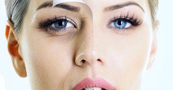Ringiovanire la pelle del viso con la carbossiterapia