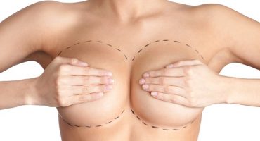 Miglior chirurgo plastico seno