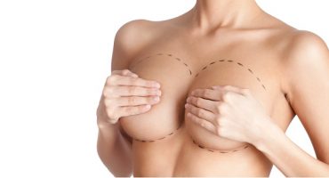 Rifarsi il seno: 7 miti da sfatare sulla mastoplastica additiva