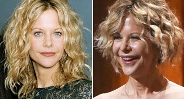 errori-chirurgia-estetica-meg-ryan